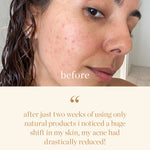 
  
  Testimony of skin clearing results from A swatch of Ere Perez Moringa All Beauty Crème
  
