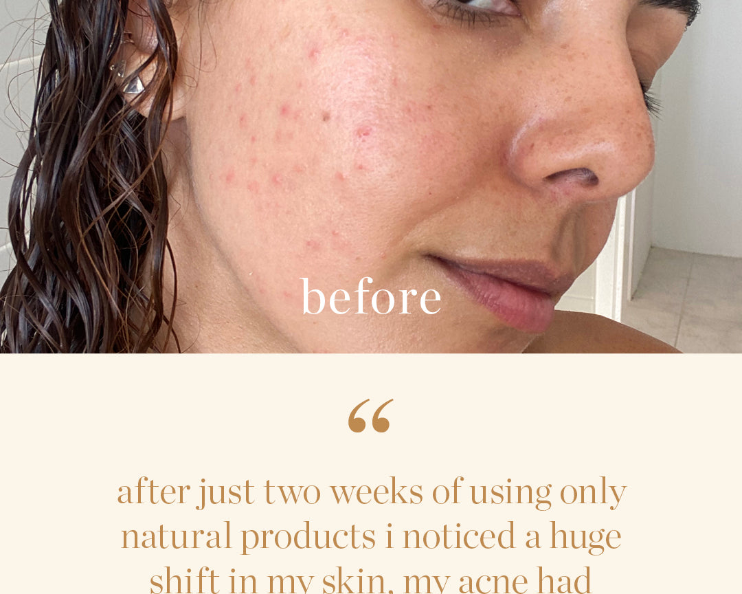 
  
  Testimony of skin clearing results from A swatch of Ere Perez Moringa All Beauty Crème
  
