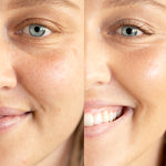 
  
  Before and after application of Ere Perez Lychee Creme Corrector Tres on a woman with light complexion and neutral undertones.
  
