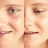 
  
  Before and after application of Ere Perez Lychee Creme Corrector Tres on a woman with light complexion and pink undertones.
  
