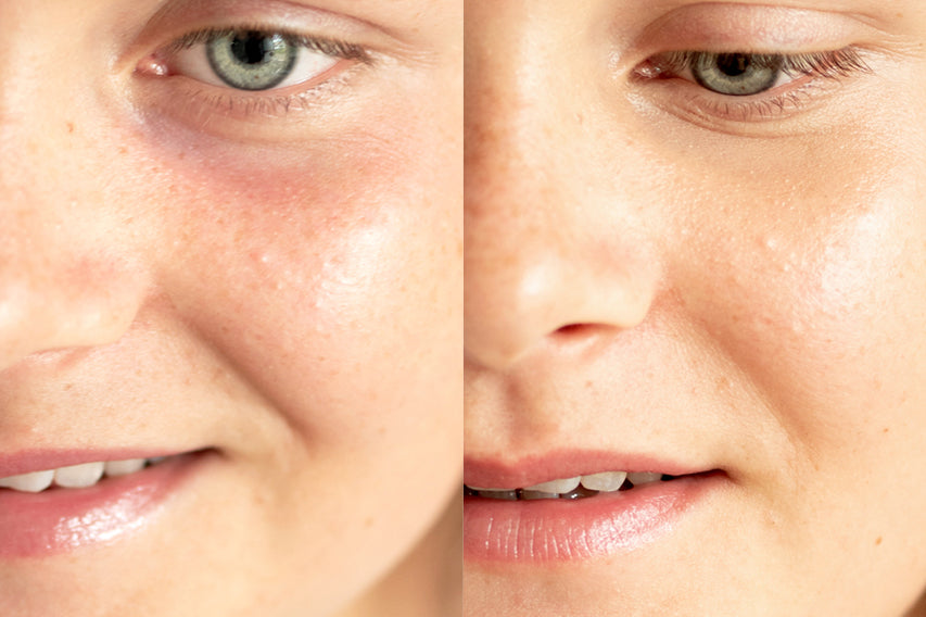 
  
  Before and after application of Ere Perez Lychee Creme Corrector Tres on a woman with light complexion and pink undertones.
  
