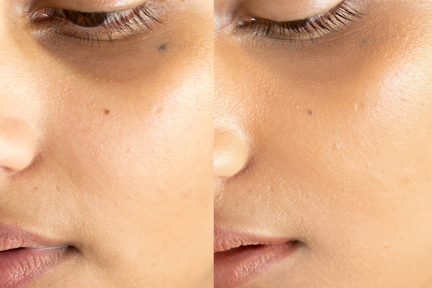 
  
  A before and after of Ere Perez Lychee Creme Corrector Cinco on a woman with medium complexion and neutral undertones.
  
