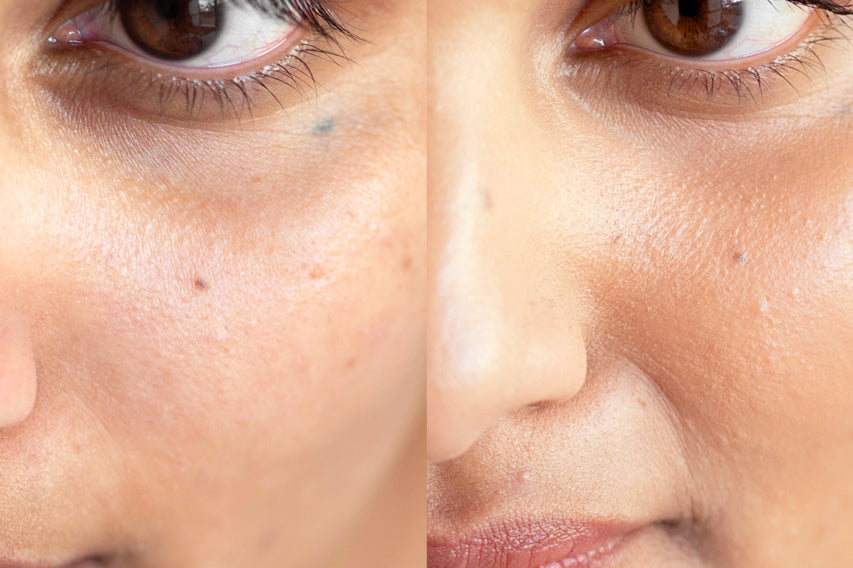 
  
  A before and after of Ere Perez Lychee Creme Corrector Cinco on a woman with medium complexion and pink undertones.
  
