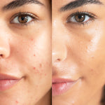 
  
  A before and after of Ere Perez Lychee Creme Corrector Cinco on a woman with medium complexion and golden undertones.
  
