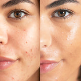 
  
  A before and after of Ere Perez Lychee Creme Corrector Cinco on a woman with medium complexion and golden undertones.
  
