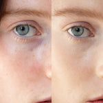 
  
  A close-up comparison of Ere Perez Lychee Creme Corrector Uno on a woman with light complexion and pink undertones.
  

