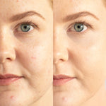 
  
  A before and after application of Ere Perez Lychee Creme Corrector Uno on a woman with light complexion and pink undertones.
  
