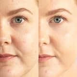 
  
  A before and after application of Ere Perez Lychee Creme Corrector Uno on a woman with light complexion and pink undertones.
  
