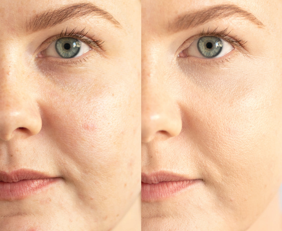 
  
  A before and after application of Ere Perez Lychee Creme Corrector Uno on a woman with light complexion and pink undertones.
  
