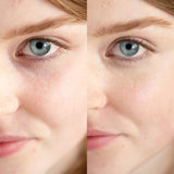 
  
  A close-up comparison of Ere Perez Lychee Creme Corrector Uno on a woman with light complexion and pink undertones.
  
